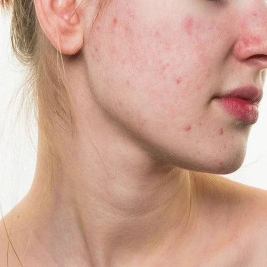 Is Sunscreen bad for you?