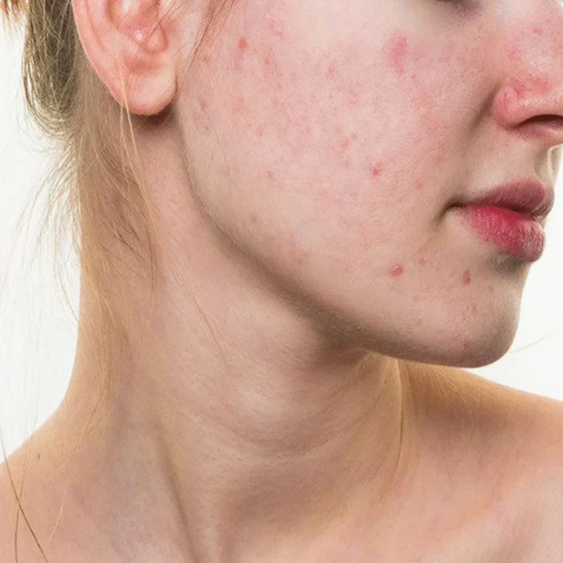 Is Sunscreen bad for you?