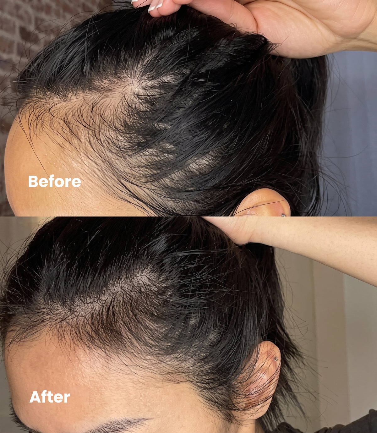 Hair Growth Serum