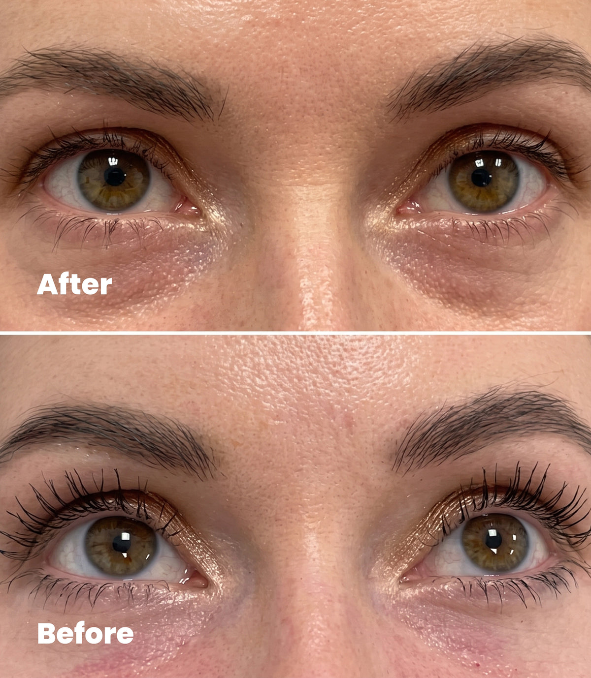 Hyaluronic Acid | Eye Contour 20 ml