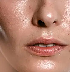 Oily skin